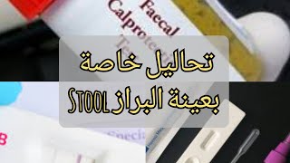 تحاليل خاصة بعينة البراز stool Analysis Fecal occult blood الفحص SUGER Rota virus [upl. by Aruon]