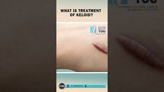 What is the Treatment for Keloid Keloid Removal Surgery in Delhi  Dr PK Talwar [upl. by Kary]