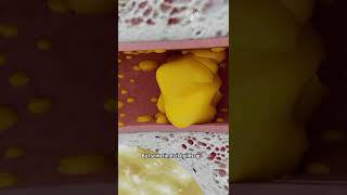 How to Remove Ear Wax Blockage the Right Way shorts facts  creativelearning3d [upl. by Memberg]