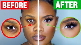 How To COVER Dark Under Eye Circles [upl. by Endys873]