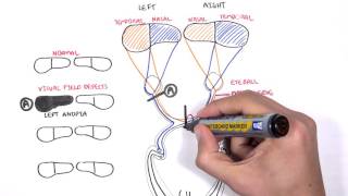 Visual Pathway and Lesions [upl. by Soilissav855]