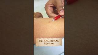 How to do an intradermal injectionTuberculin skin testing ytshorts shorts youtubeshorts doctor [upl. by Enautna]