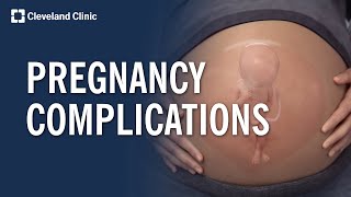 Common Pregnancy Complications Explained [upl. by Melody]