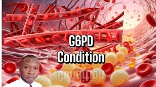 What you should known about G6PD disease [upl. by Anasiul169]