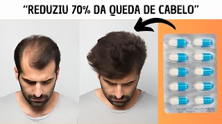 MINHA QUEDA DE CABELO DIMINUIU 70 COM O POLIVITAMÍNICO [upl. by Hertzfeld]