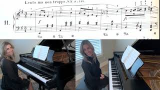 Mazurka Op 17 No 2 in E Minor by Frederic Chopin Christie Peery Skousen piano [upl. by Tresa]