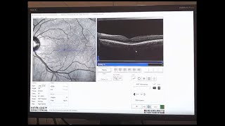 Recorded Webinar OCT LIVE Virtual Workshop  Retina [upl. by Yv]