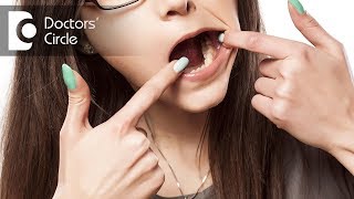 How to prevent Dental Caries  Dr Jayaprakash Ittigi [upl. by Aerdnaeel728]