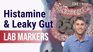 Histamine and Leaky Gut Lab Markers [upl. by Rusel]