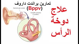 علاج دوخة الراس تمارين براندت داروف Bppv في دقيقتين [upl. by Adnofal]