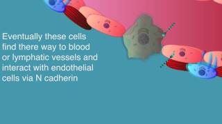 epithelialmesenchymal transition of metastasis [upl. by Marge]