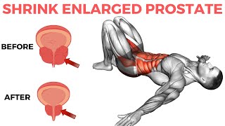 10 Minute Routine to Shrink Enlarged Prostate [upl. by Etnad453]