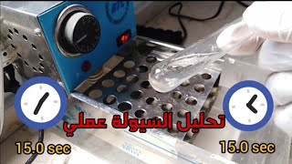 عملي البروثرومبين PT manualOpticalMagnetic [upl. by Raab]