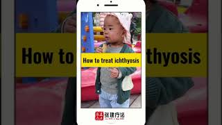 Children troubled by ichthyosis IchthyosisVulgaris LamellarIchthyosis ErythrodermIcichthyosis [upl. by Lydell792]