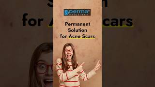 Acne Treatment for Acne Marks amp Scars  Micro needling Radio Frequency MNRF by Dr Sandeep Mahapatra [upl. by Gonroff]