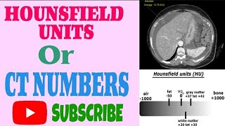 Lec 5  HOUNSFIELD UNITS or CT NUMBERS  Computed Tomography Physics [upl. by Koh]