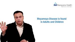 What is Moyamoya Disease and is it curable  Dr Anurag Saxena English [upl. by Ddal355]