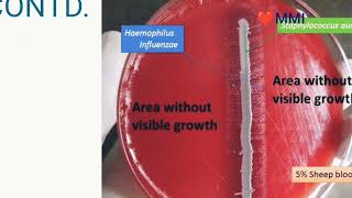 HAEMOPHILUS INFLUENZAE PNEUMONIA  MICROBIOLOGY [upl. by Trilby]