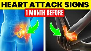 6 Signs Youll Have a Heart Attack in 1 Month 2024 [upl. by Ulphiah]