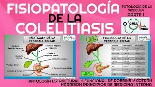 COLELITIASIS FISIOPATOLOGÍA GuiaMed [upl. by Sadie872]