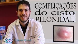 Complicações do cisto pilonidal  Dr Marcelo Werneck [upl. by Kristof]