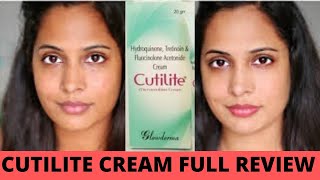 CUTILITE CREAM FULL REVIEW Top FAIRNESS Cream in India  instant fair skin  Will this make you fair [upl. by Favien]