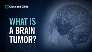 Primary Brain Tumors  What Are They and How Do They Form [upl. by Coretta]