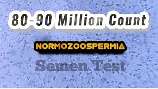 Normozoospermia semen Analysis [upl. by Notloc]