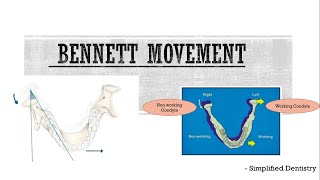 Bennett movement [upl. by Annaej604]