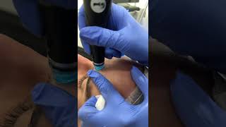 HYDRAFACIAL in slow motion  Dr Medsipa [upl. by Nylahsoj]