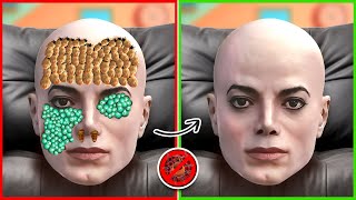 Michael Jackson ASMR Treatment  Remove Maggots amp Dog Ticks From MJ  Severely Injured Treatment [upl. by Ennairol]