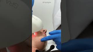 IPL Treatment Gimana Cara Kerjanya ipl shorts [upl. by Kornher398]