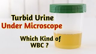 Turbid urine pus cell  Turbid urine under Microscope [upl. by Sesom968]