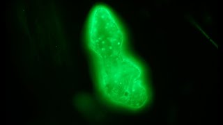 Acridine orange staining for fluorescence  first attempt [upl. by Stanislaus]