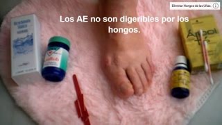 HONGOS EN LAS UÑAS DE LAS MANOS Y PIES TUTORIAL CON ACEITE ESENCIAL VICKSVAPORUB Y BICARBONATO ✿ [upl. by Vivian]