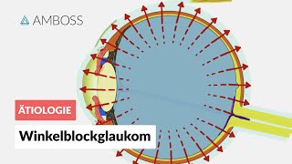 Akutes Winkelblockglaukom bei Pupillarblock  AMBOSS Video [upl. by Eednahs]