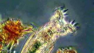 Rotifer Feeding II [upl. by Akemrej]