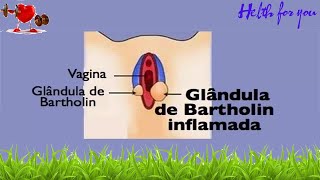 O que causa a inflamação da glândula de bartholin [upl. by Eiltan597]