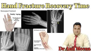 hand bone fracture recovery time  hand Fracture treatment  hand Fracture Exercises in hindi [upl. by Claire]