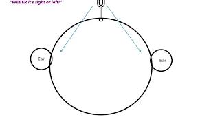 Weber vs Rinne Test amp Conductive vs Sensorineural Hearing Loss [upl. by Cohl]