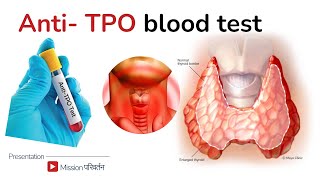 AntiTPO antibodies  treatment for high antiTPO [upl. by Scrope581]