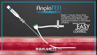 AngioTEN®️ Vascular Closure Device [upl. by Merdith]