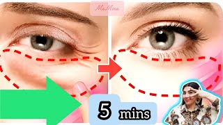 5mins 💯 AntiAging Face Exercise For Eye Bags  Eye Wrinkles  Dark Circles [upl. by Nawor]