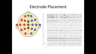 Understanding the EEG [upl. by Austreng720]