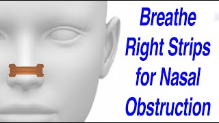 Breathe Right Nasal Strips to Resolve Nasal Obstruction [upl. by Dadivitan567]