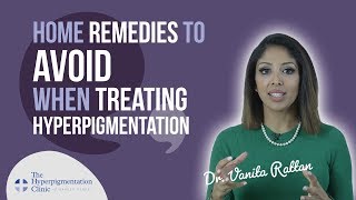 How to Treat Hyperpigmentation  Home Remedies  DO THEY WORK [upl. by Isayg701]