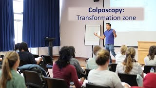 Colposcopy Transformation Zone for the MRCOG by Dr Justin Chu [upl. by Libove]