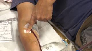 An easy way to control dialysis bleeding for patients with coagulation problems [upl. by Thury]