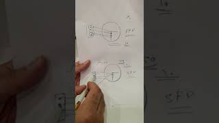 شرح الفرق بين FFP و SFP في الدرابيل معلومات مهمه FFP VS SFP [upl. by Nuriel392]