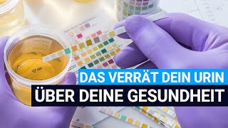 Was die Farbe deines Urins über deine Gesundheit verrät [upl. by Goran]